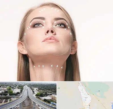 لیفت صورت با نخ در اندیمشک