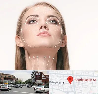 لیفت صورت با نخ در خیابان آذربایجان