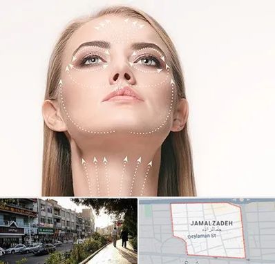 لیفت صورت با نخ در خیابان جمالزاده