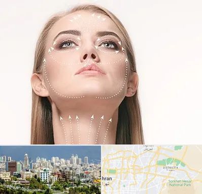 لیفت صورت با نخ در شرق تهران 