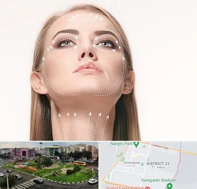 لیفت صورت با نخ در تهرانسر 