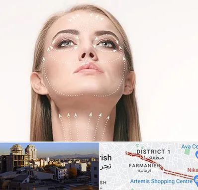 لیفت صورت با نخ در فرمانیه 