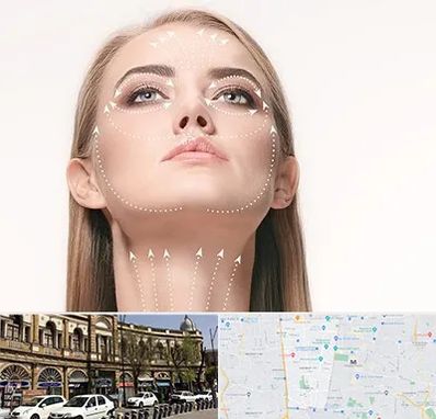 لیفت صورت با نخ در منطقه 11 تهران 