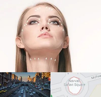 لیفت صورت با نخ در نواب