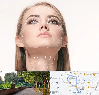 لیفت صورت با نخ در بلوار گیلان رشت