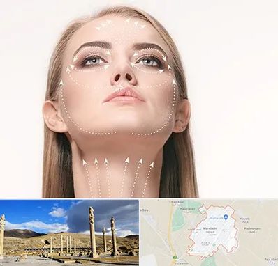 لیفت صورت با نخ در مرودشت