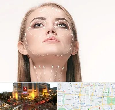 لیفت صورت با نخ در جنت آباد تهران 