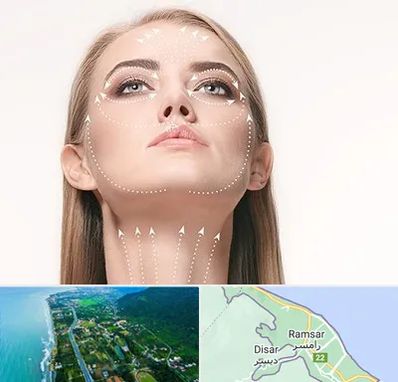 لیفت صورت با نخ در رامسر