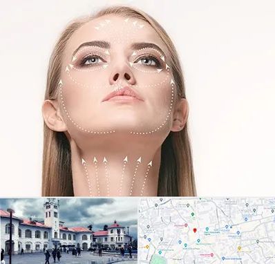 لیفت صورت با نخ در میدان شهرداری رشت