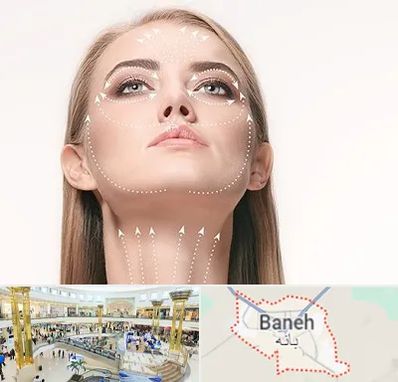 لیفت صورت با نخ در بانه