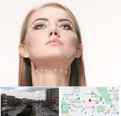 لیفت صورت با نخ در بلوار فردوسی مشهد 