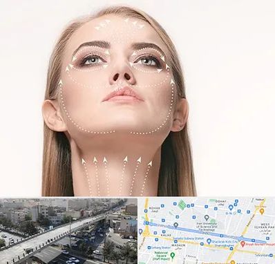 لیفت صورت با نخ در فرجام