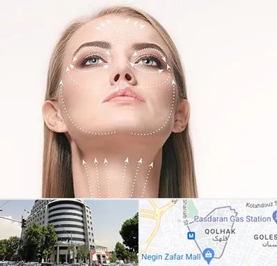 لیفت صورت با نخ در قلهک 