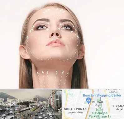 لیفت صورت با نخ در پونک 