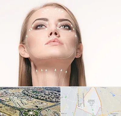 لیفت صورت با نخ در اندیشه