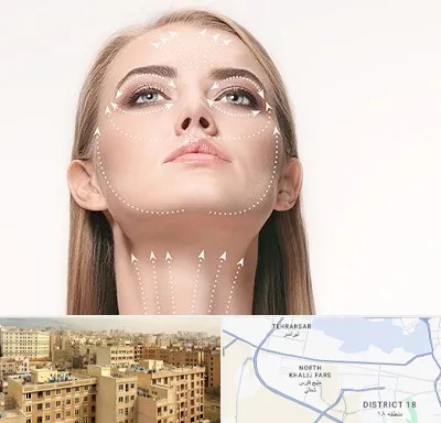لیفت صورت با نخ در جنوب غرب تهران