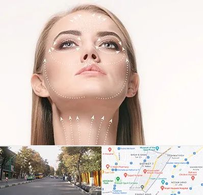 لیفت صورت با نخ در شریعتی 