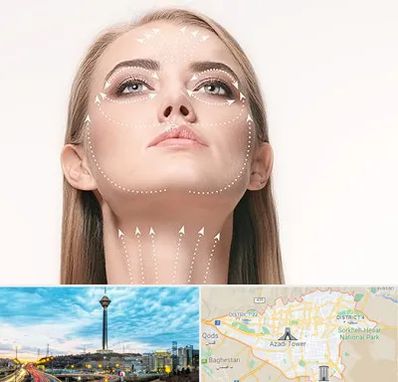 لیفت صورت با نخ در تهران