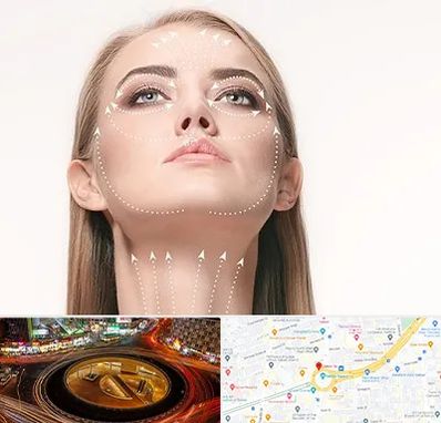 لیفت صورت با نخ در میدان ولیعصر 