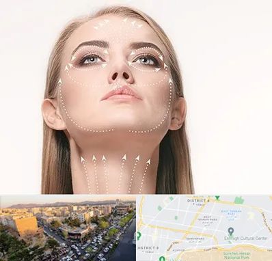 لیفت صورت با نخ در تهرانپارس 