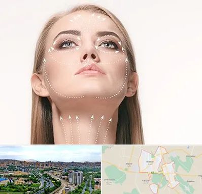 لیفت صورت با نخ در شهریار