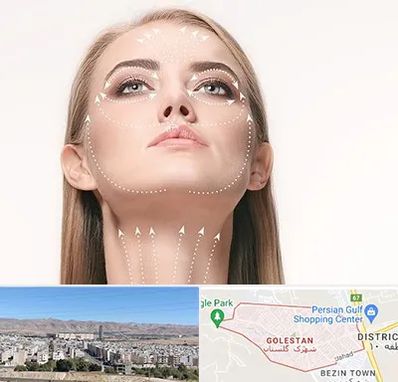 لیفت صورت با نخ در شهرک گلستان شیراز