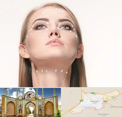 لیفت صورت با نخ در سمنان