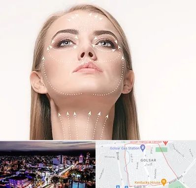 لیفت صورت با نخ در گلسار رشت 