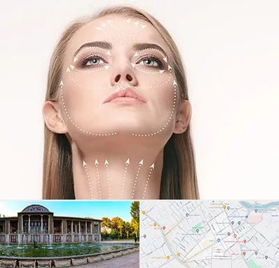 لیفت صورت با نخ در عفیف آباد شیراز