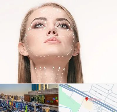 لیفت صورت با نخ در لاله پارک تبریز