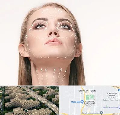 لیفت صورت با نخ در اکباتان 