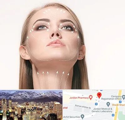 لیفت صورت با نخ در جردن 