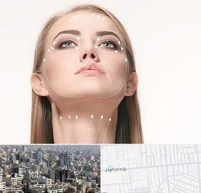 لیفت صورت با نخ در جیحون