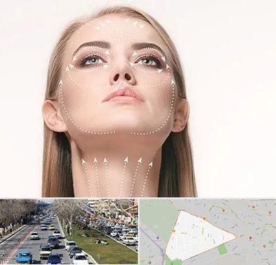 لیفت صورت با نخ در احمدآباد مشهد 