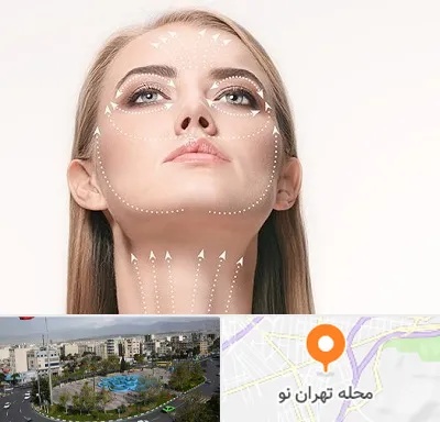 لیفت صورت با نخ در تهران نو