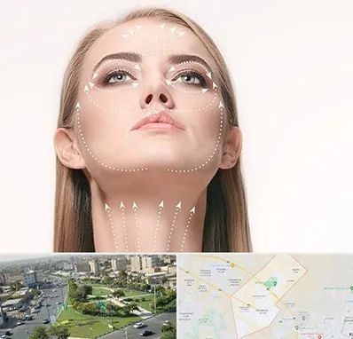 لیفت صورت با نخ در کمال شهر کرج 