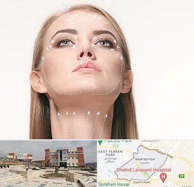 لیفت صورت با نخ در حکیمیه 