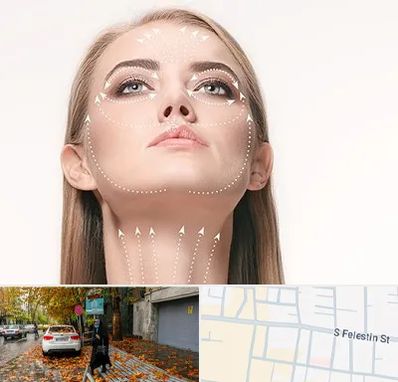 لیفت صورت با نخ در خیابان فلسطین