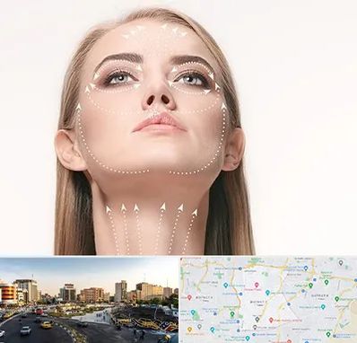 لیفت صورت با نخ در منطقه 7 تهران 