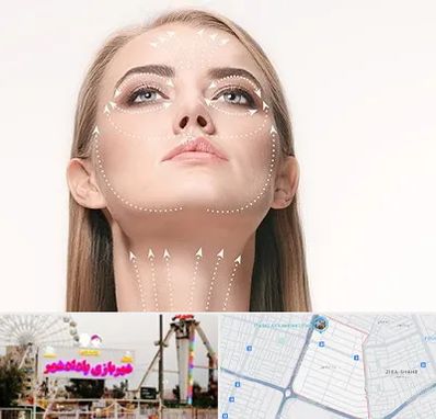 لیفت صورت با نخ در پادادشهر اهواز