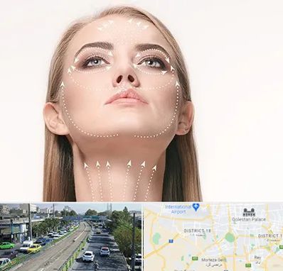 لیفت صورت با نخ در جنوب تهران 