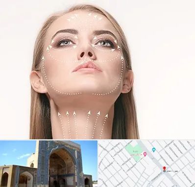 لیفت صورت با نخ در مصلی مشهد