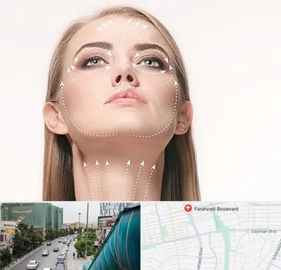 لیفت صورت با نخ در بلوار فرحزادی