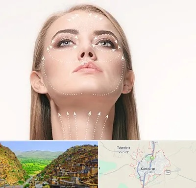 لیفت صورت با نخ در کامیاران