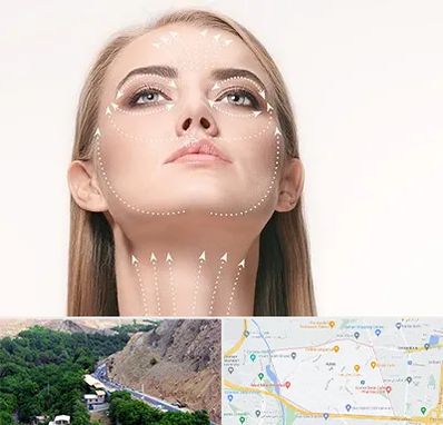 لیفت صورت با نخ در کن 