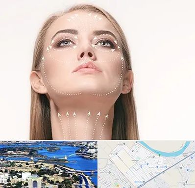 لیفت صورت با نخ در کوروش اهواز