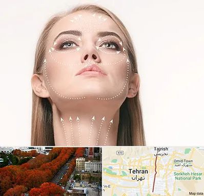 لیفت صورت با نخ در ولیعصر 