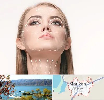 لیفت صورت با نخ در مریوان