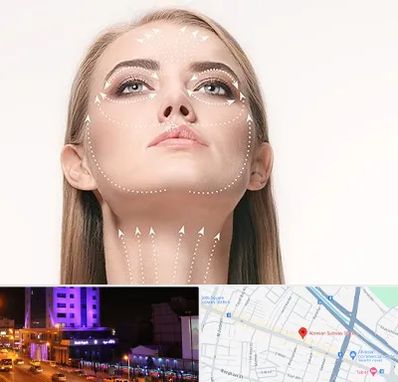 لیفت صورت با نخ در آبرسان تبریز