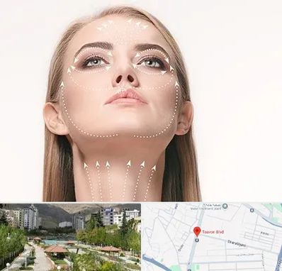 لیفت صورت با نخ در بلوار تعاون